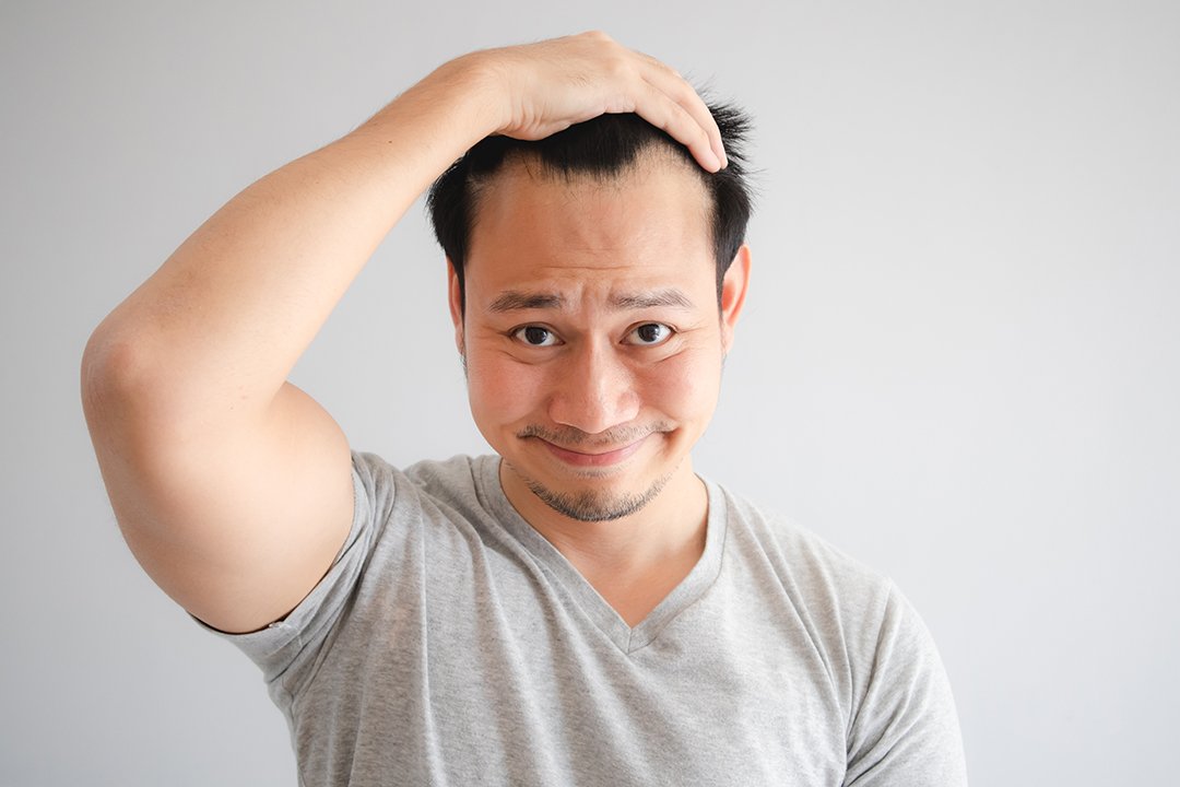Alkohol Bikin Rambut Rontok? Ini Faktanya
